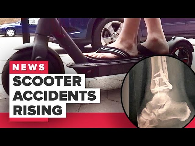 CNET: Electric scooter injuries on the rise (CNET News)