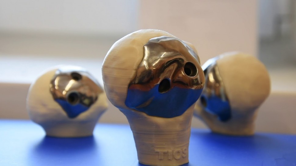 ​Технопарк «Анкудиновка»: Медицина будущего: протезирование суставов | победители конкурса "УМНИК"
